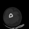 SPORK, NICO - 22.03.1976 - 02.08.2022 - CT obere Extremität - 17:51:17